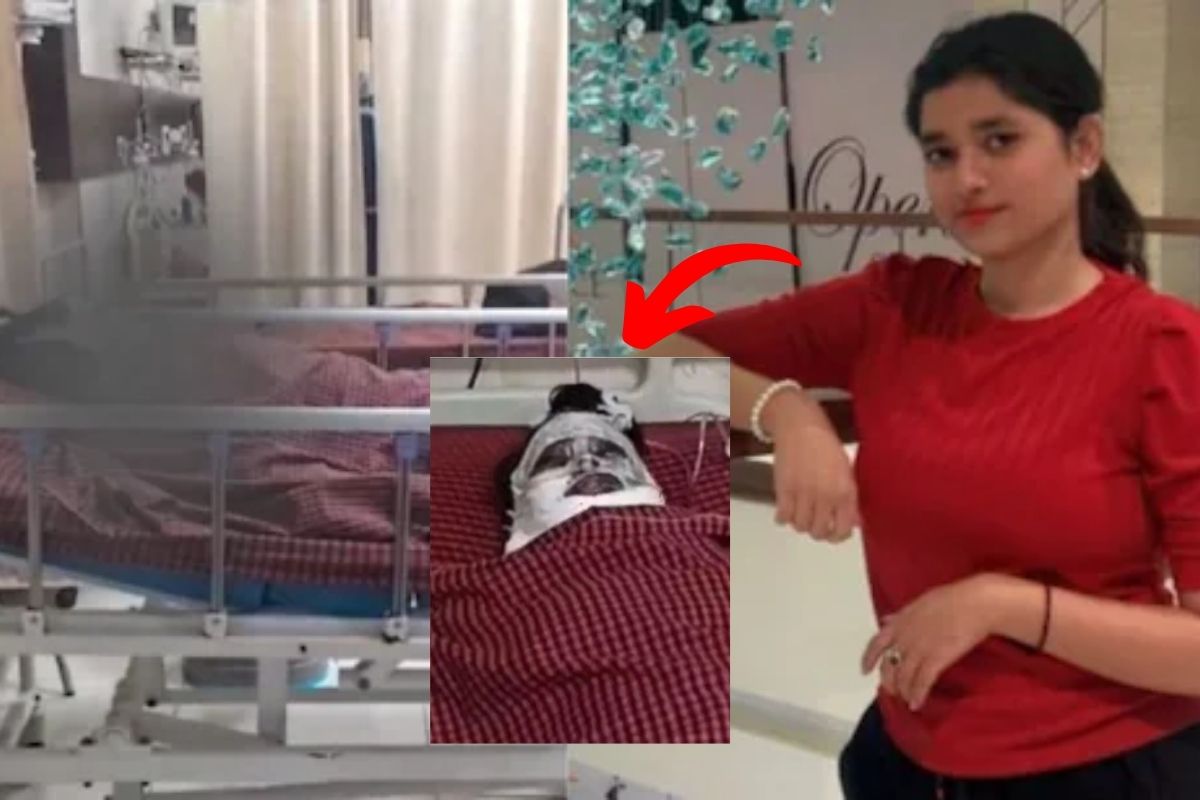Jabalpur Acid Attack: जलन और ईर्ष्या में दोस्त ने चेहरे पर फेंका तेजाब, 50% जल गई दोस्त की त्वचा