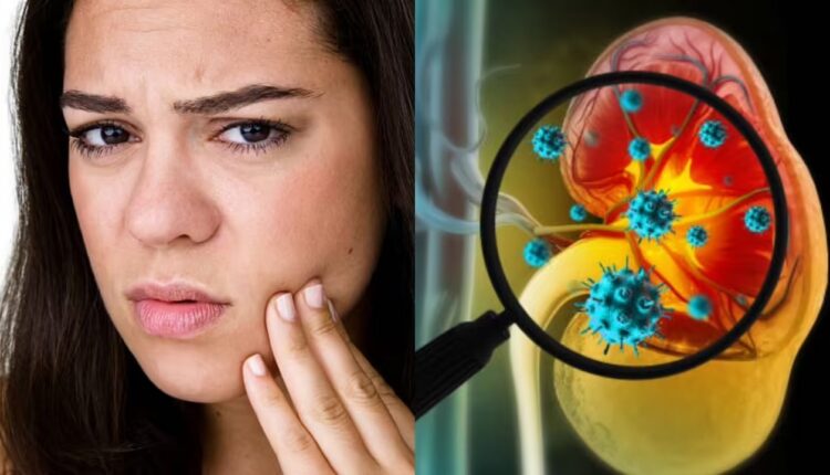 Kidney Damage Signals