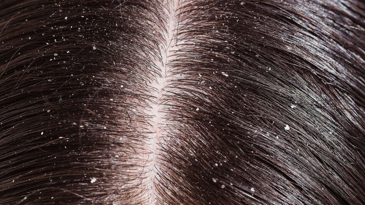 Reetha For Hair